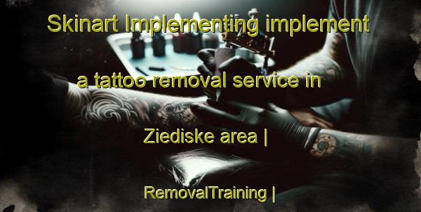 Skinart Implementing implement a tattoo removal service in Ziediske area | RemovalTraining | RemovalClasses | SkinartTraining-Lithuania